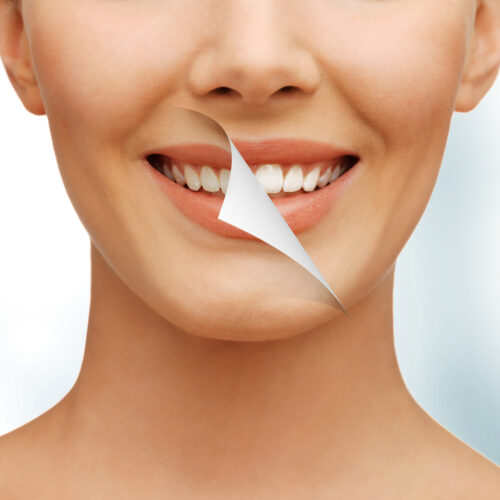Natural methods of teeth whitening